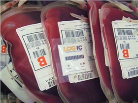 血袋不干膠標簽 血袋不干膠標簽